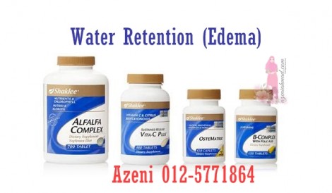 Water retention, edema, cara atasi water retention