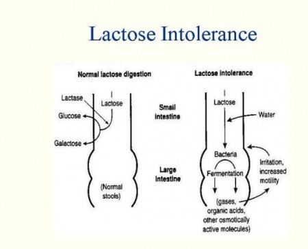 Apakah itu lactose intolerance?