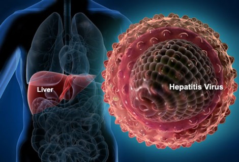 Apa itu hepatitis